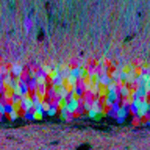 Meet your Posher, Yj